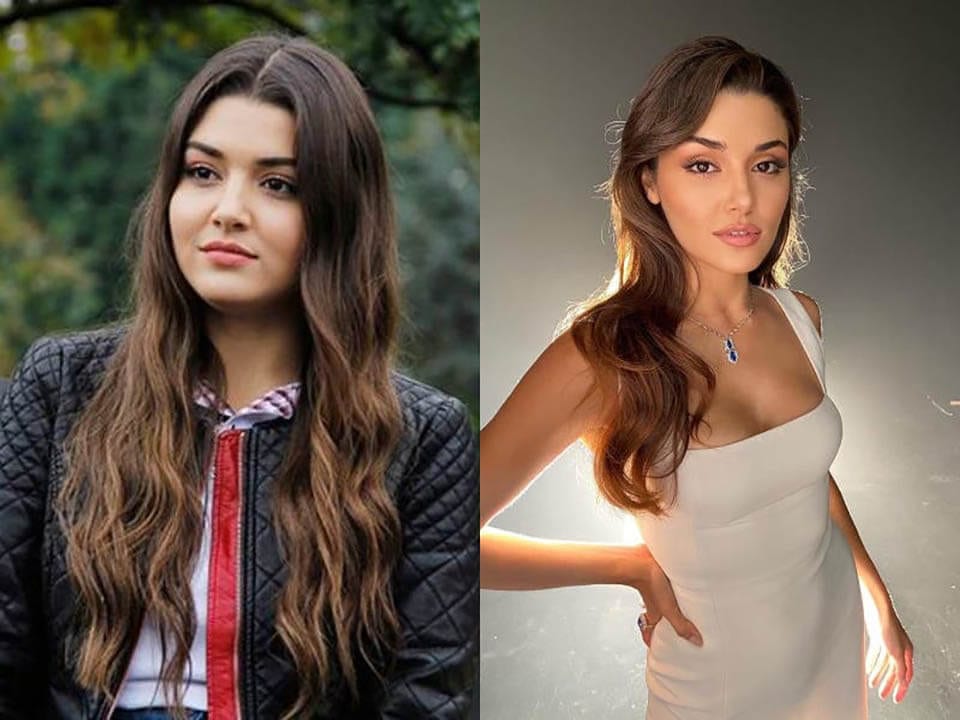 Before and After: Hande Ercel Plastic Surgery