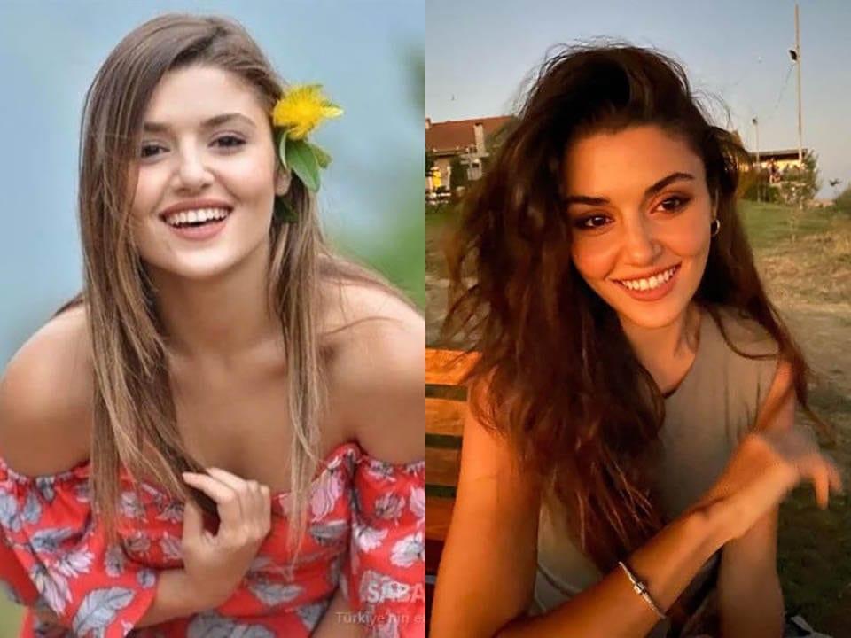 Before and After: Hande Ercel Plastic Surgery
