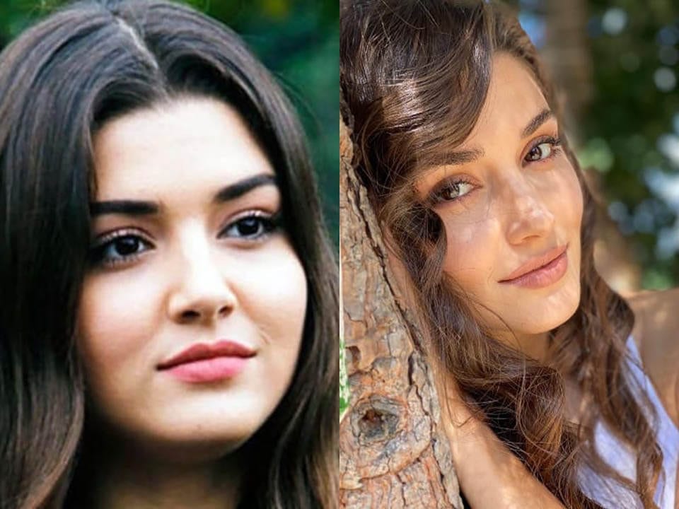 Before and After: Hande Ercel Plastic Surgery