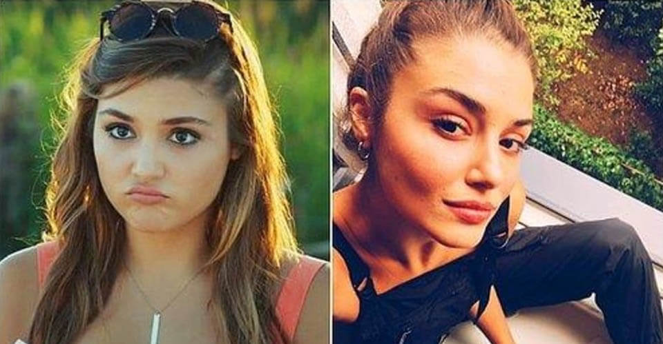 Before and After: Hande Ercel Plastic Surgery